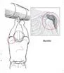 diagram of construction worker reaching over his head with a red circle around his shoulder joint